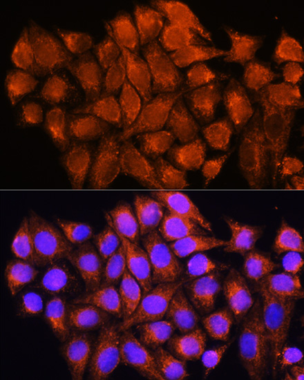 Anti-ATP5D Polyclonal Antibody (CAB9929)