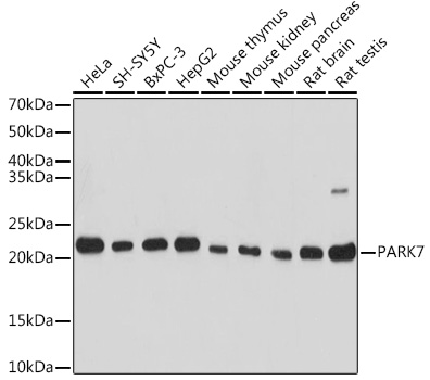 Anti-PARK7 Antibody (CAB18580)