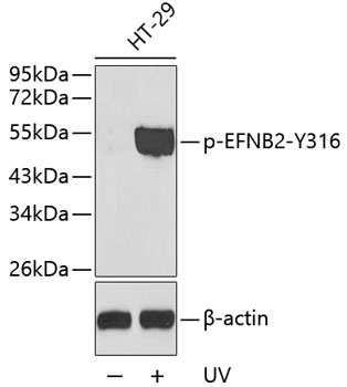 Anti-Phospho-Ephrin-B2-Y316 Antibody (CABP0338)