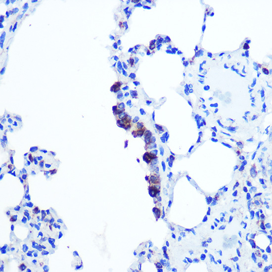 Anti-TOP1MT Antibody (CAB15559)