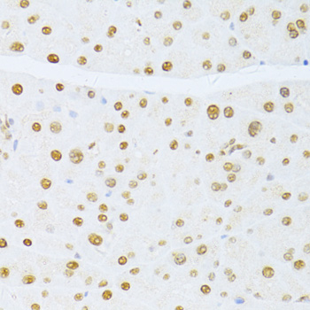 Anti-ETV1 Antibody (CAB13303)