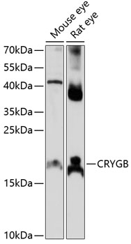 Anti-CRYGB Antibody (CAB14569)