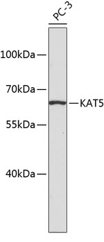 Anti-KAT5 Antibody (CAB2292)