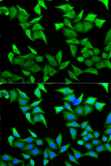 Anti-Nectin 2/CD112 Antibody (CAB5378)