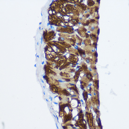 Anti-PPP1CB Antibody (CAB1088)