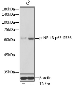 Anti-Phospho-RELA-S536 Antibody (CABP0475)