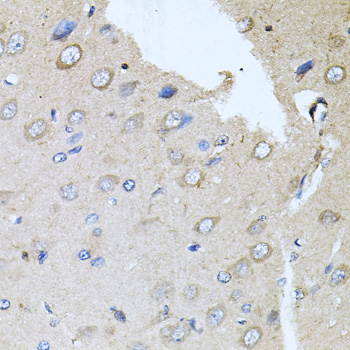 Anti-RARA Antibody (CAB14057)