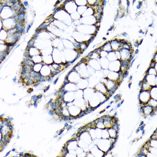 Anti-HK2 Antibody [KO Validated] (CAB0994)