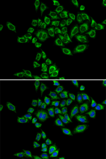 Anti-SRPK1 Antibody (CAB5854)