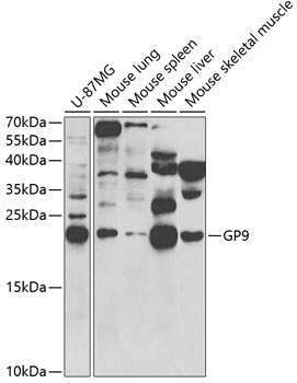 Anti-GP9 Antibody (CAB5374)