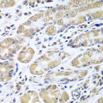 Anti-EIF1AX Antibody (CAB5917)