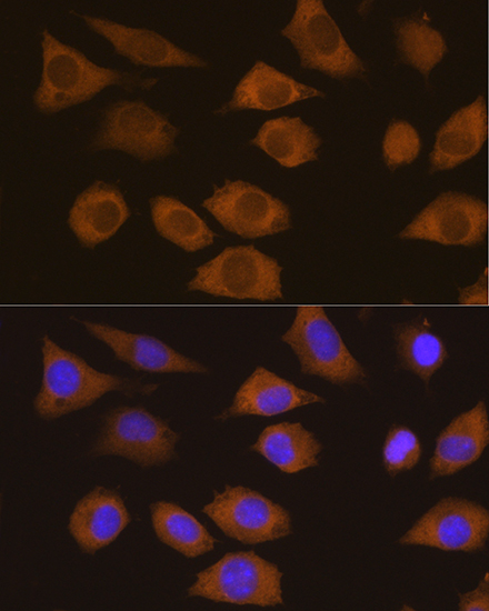 Anti-CSDE1 Antibody [KO Validated] (CAB5941)