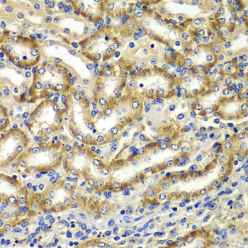 Anti-DGKE Antibody (CAB7752)