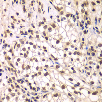 Anti-SMARCC1 Antibody [KO Validated] (CAB6128)