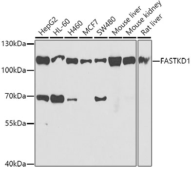 Anti-FASTKD1 Antibody (CAB7384)