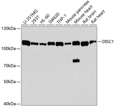 Anti-DISC1 Antibody (CAB2898)