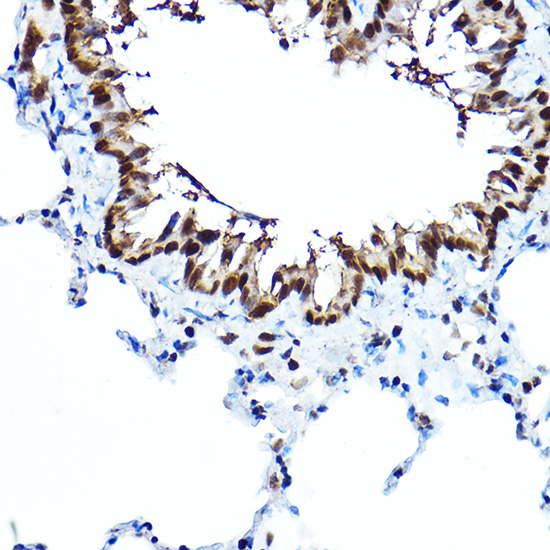 Anti-FOXA1 Antibody (CAB15278)