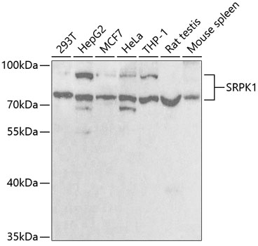 Anti-SRPK1 Antibody (CAB5854)