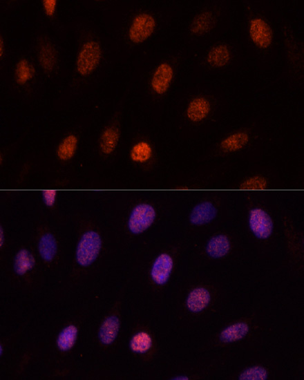 Anti-PCGF1 Antibody (CAB6338)