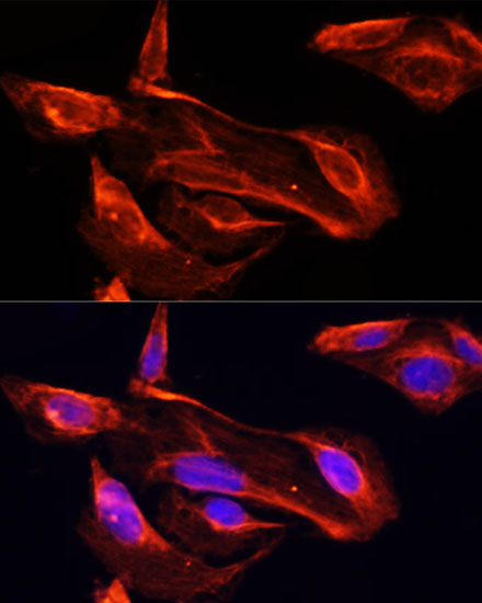 Anti-MMP2 Antibody (CAB11144)