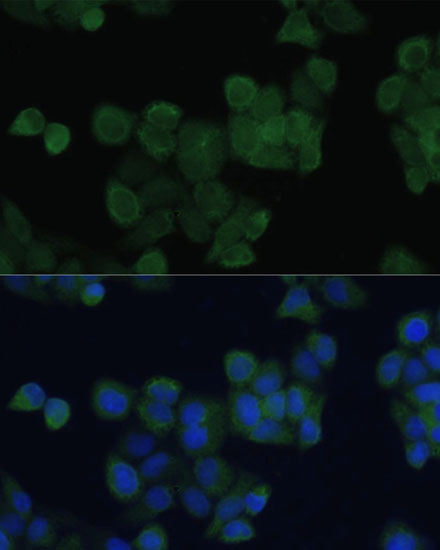 Anti-ZFYVE9 Polyclonal Antibody (CAB9041)