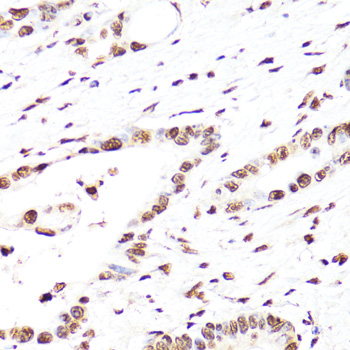 Anti-TriMethyl-Histone H3-K27 Mouse Monoclonal Antibody (CAB16199)