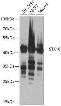 Anti-Syntaxin-16 Polyclonal Antibody (CAB8168)