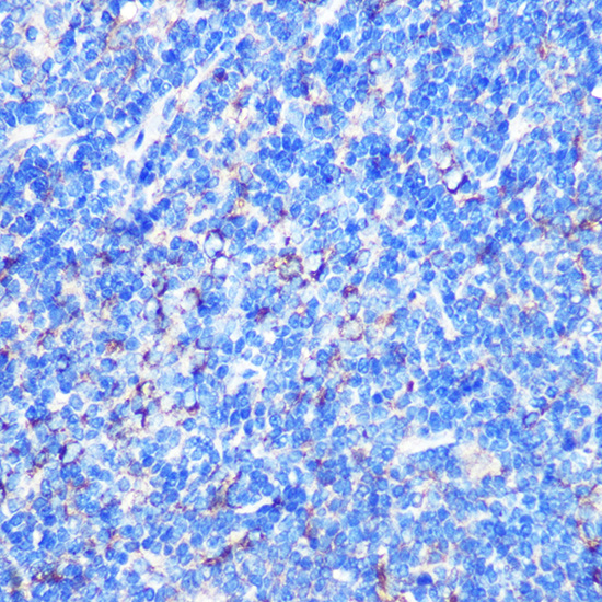 Anti-STK26 Antibody (CAB16534)