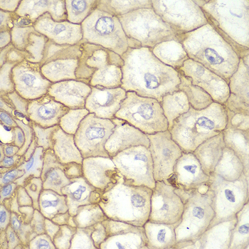 Anti-HLA-A Antibody (CAB2167)