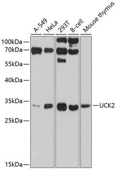 Anti-UCK2 Antibody (CAB10815)