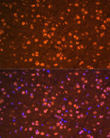 Anti-OTX2 Antibody (CAB14036)