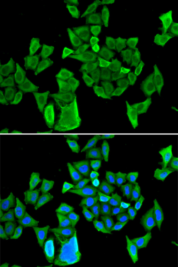 Anti-CCAR1 Antibody (CAB13595)