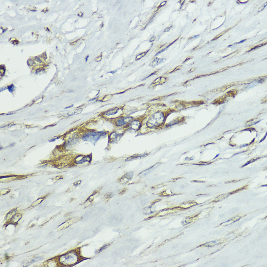 Anti-SOCS5 Antibody (CAB7952)