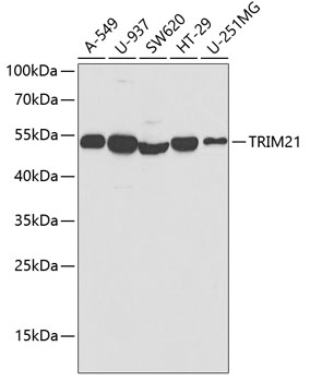 Anti-TRIM21 Antibody (CAB1957)