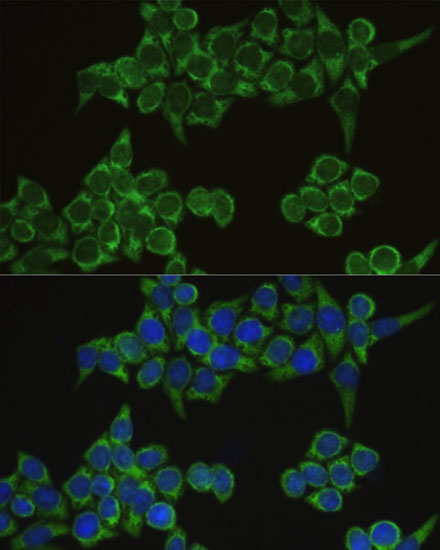 Anti-IRF3 Antibody (CAB2172)