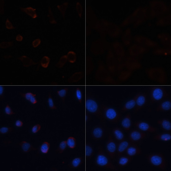 Anti-acetyl-ACC1 Antibody (CAB15606)