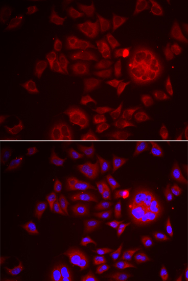 Anti-SPINT1 Antibody (CAB6411)