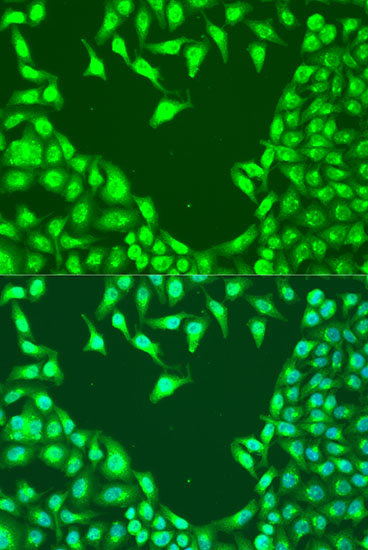 Anti-MAP2K4 Antibody (CAB7724)