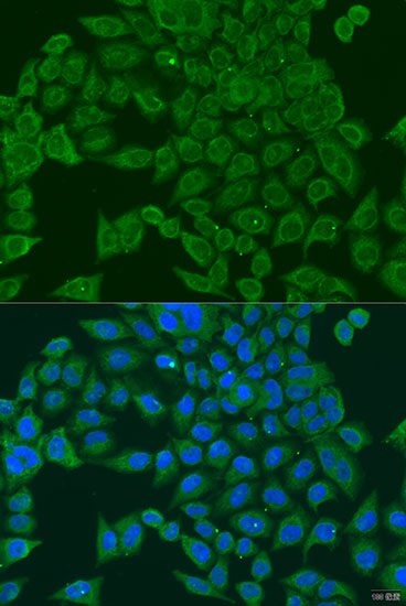 Anti-PIWIL-1 Antibody (CAB6823)