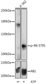 Anti-Phospho-RB-S795 Antibody (CABP0088)