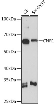 Anti-CNR1 Antibody (CAB1447)