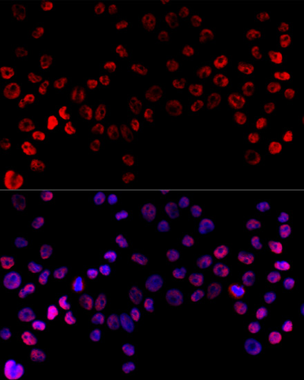 Anti-HNRNPH1 Antibody (CAB5924)