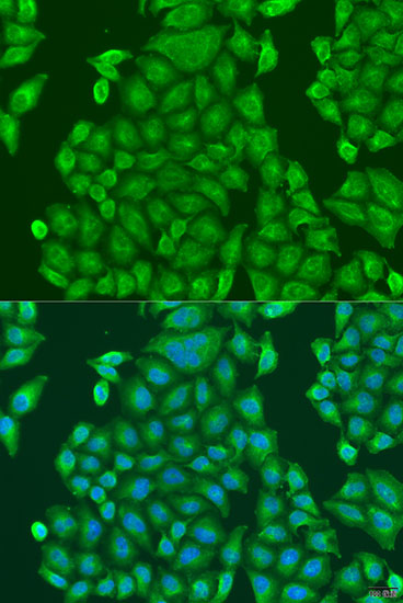 Anti-CENPK Antibody (CAB7627)