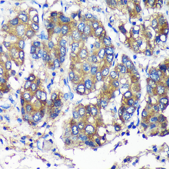 Anti-SEC23IP Antibody (CAB15398)