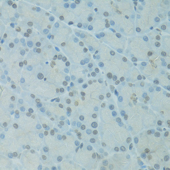 Anti-GTF2H2C Antibody (CAB5239)