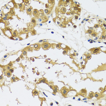 Anti-RPS12 Antibody (CAB5890)