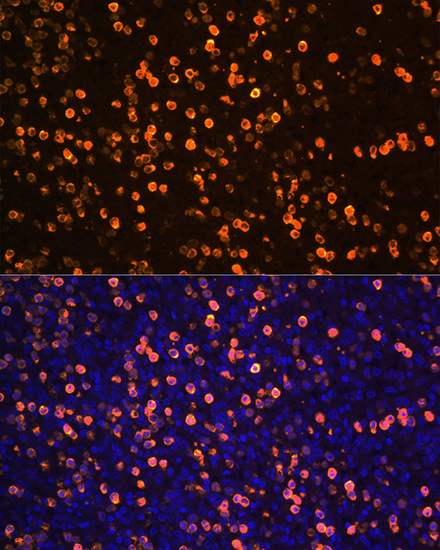 Anti-S100A12 Antibody (CAB5328)