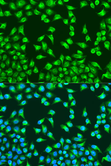 Anti-MTCO2 Antibody (CAB11154)