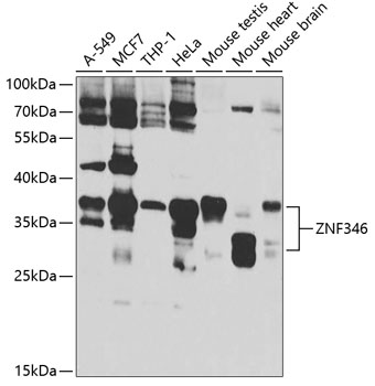 Anti-ZNF346 Antibody (CAB7507)