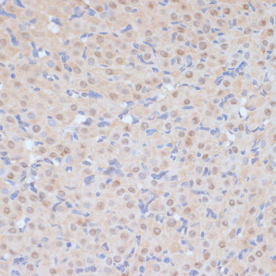 Anti-CDK9 Antibody (CAB0886)